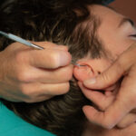 Photo auriculothérapie – médecine traditionnelle chinoise à Lille – Marylaure