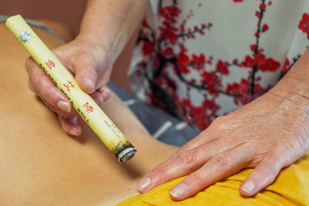 Photo moxibustion – médecine traditionnelle chinoise à Lille – Marylaure